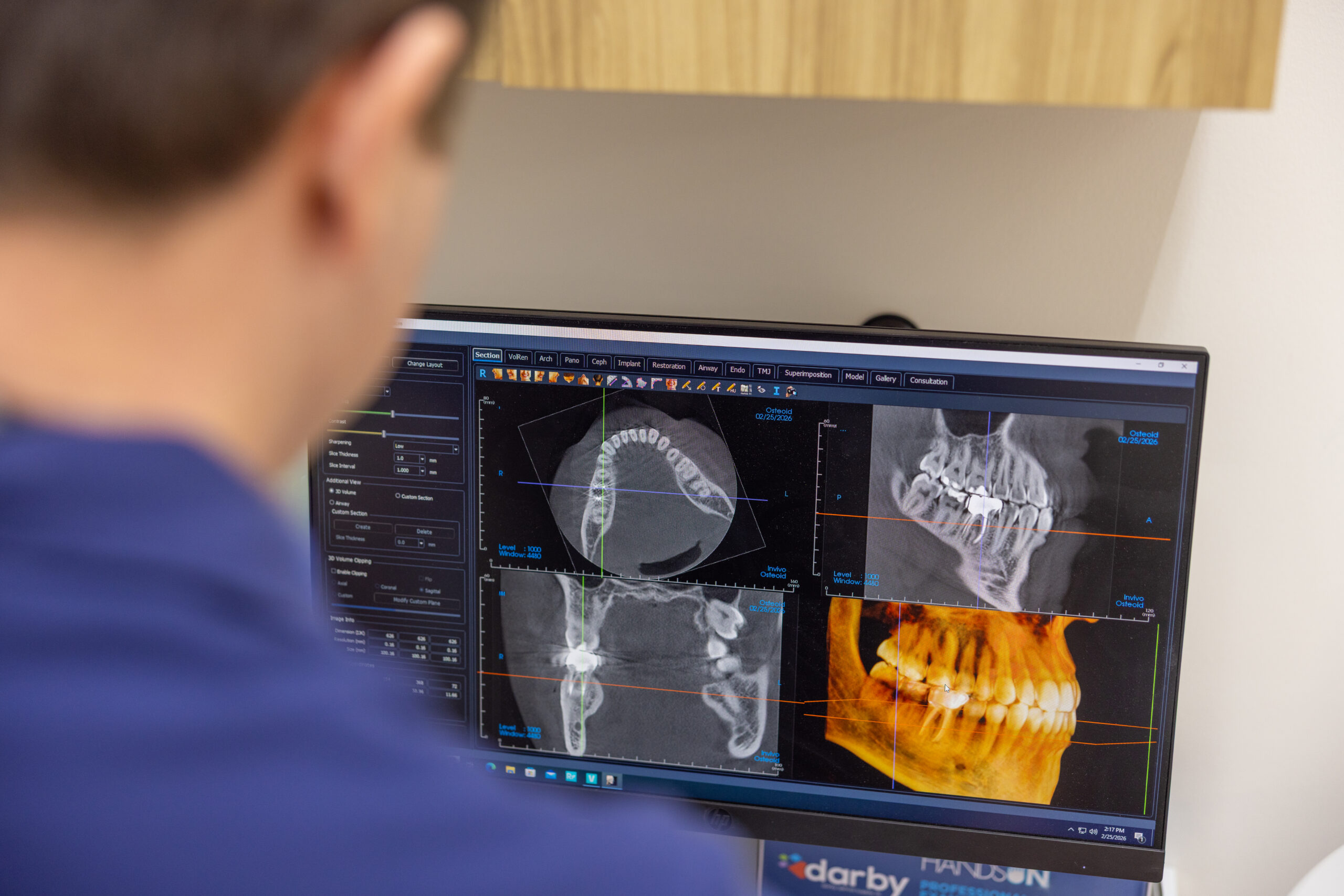 Dental implants image