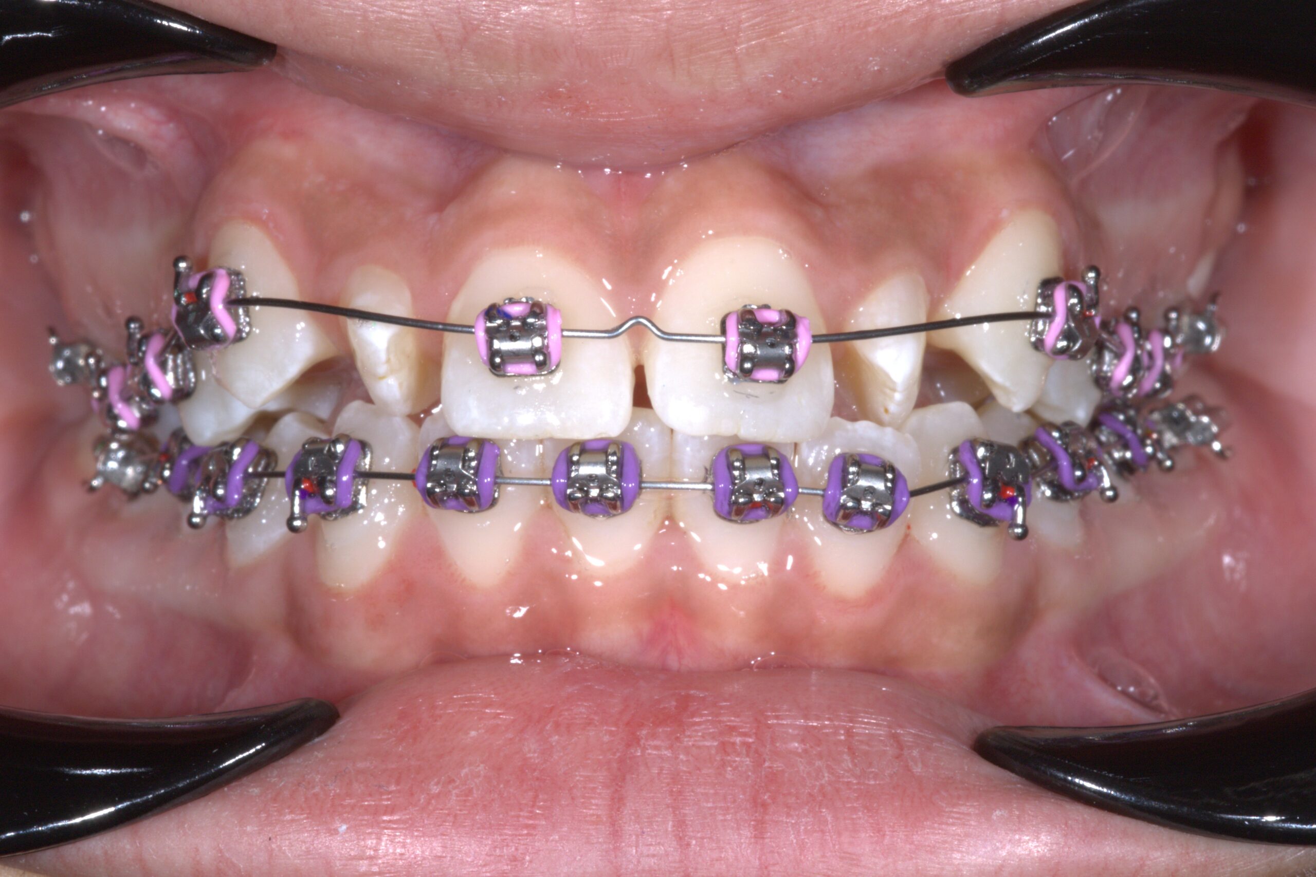 Orthodontics image 2